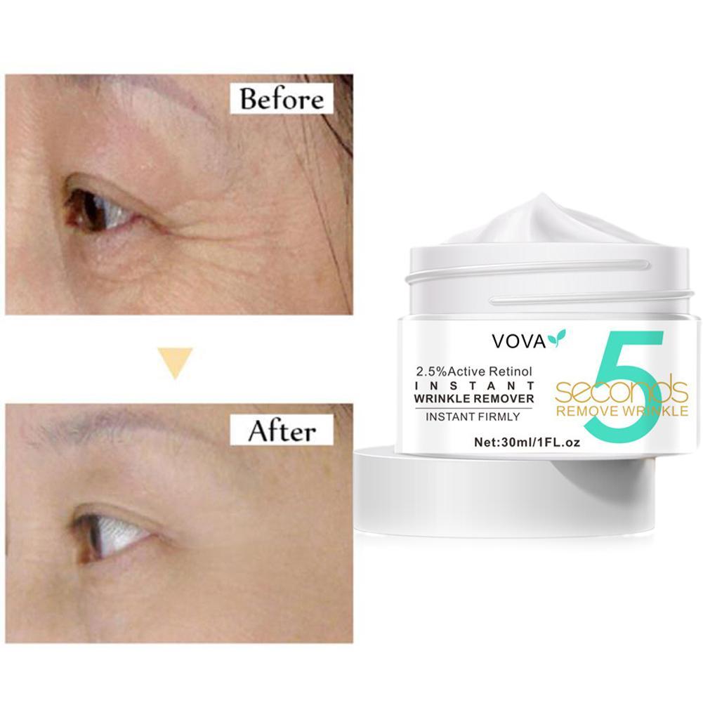 2.5% Active Retinol Eye Cream  - Milk Thistle Silymarin review and price