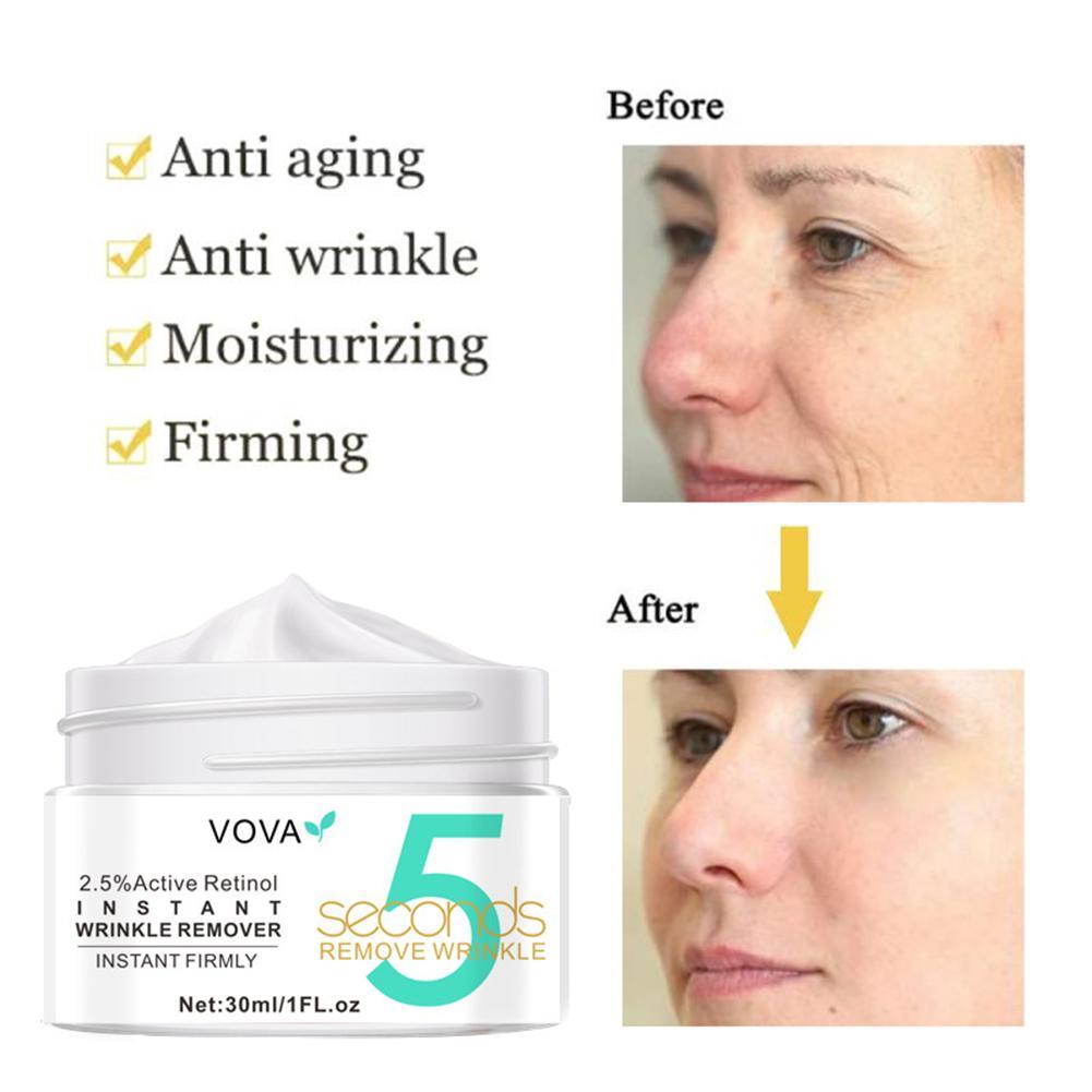 2.5% Active Retinol Eye Cream  - Milk Thistle Silymarin review and price