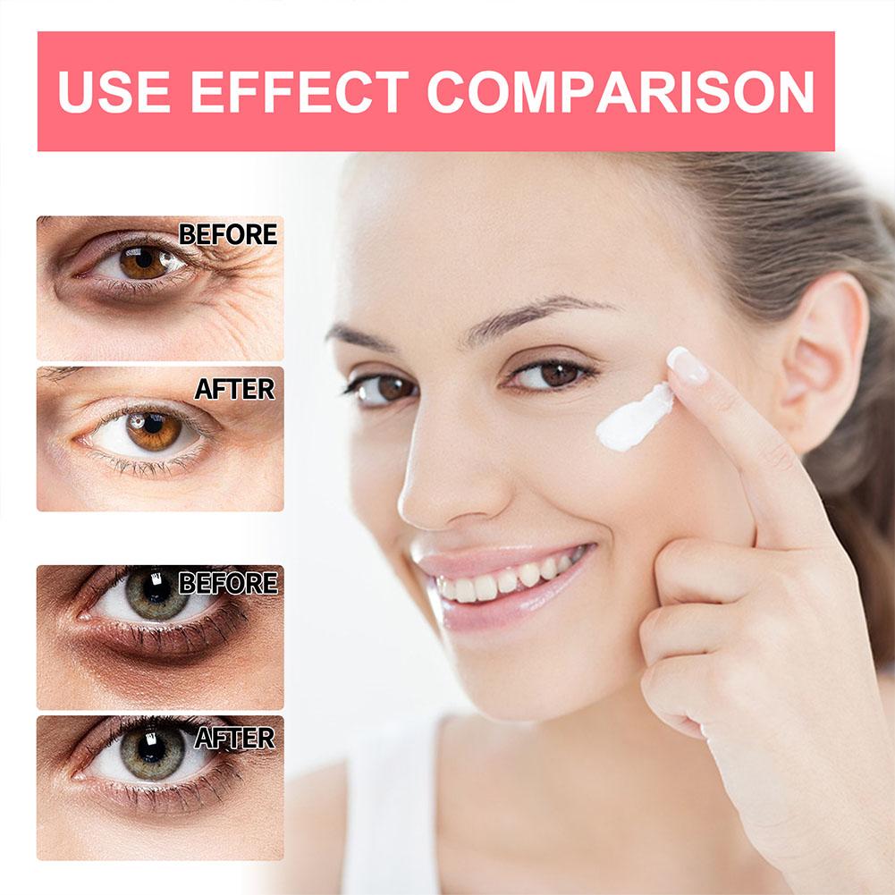 Retinol Eye Cream Lightening D - Milk Thistle Silymarin review and price